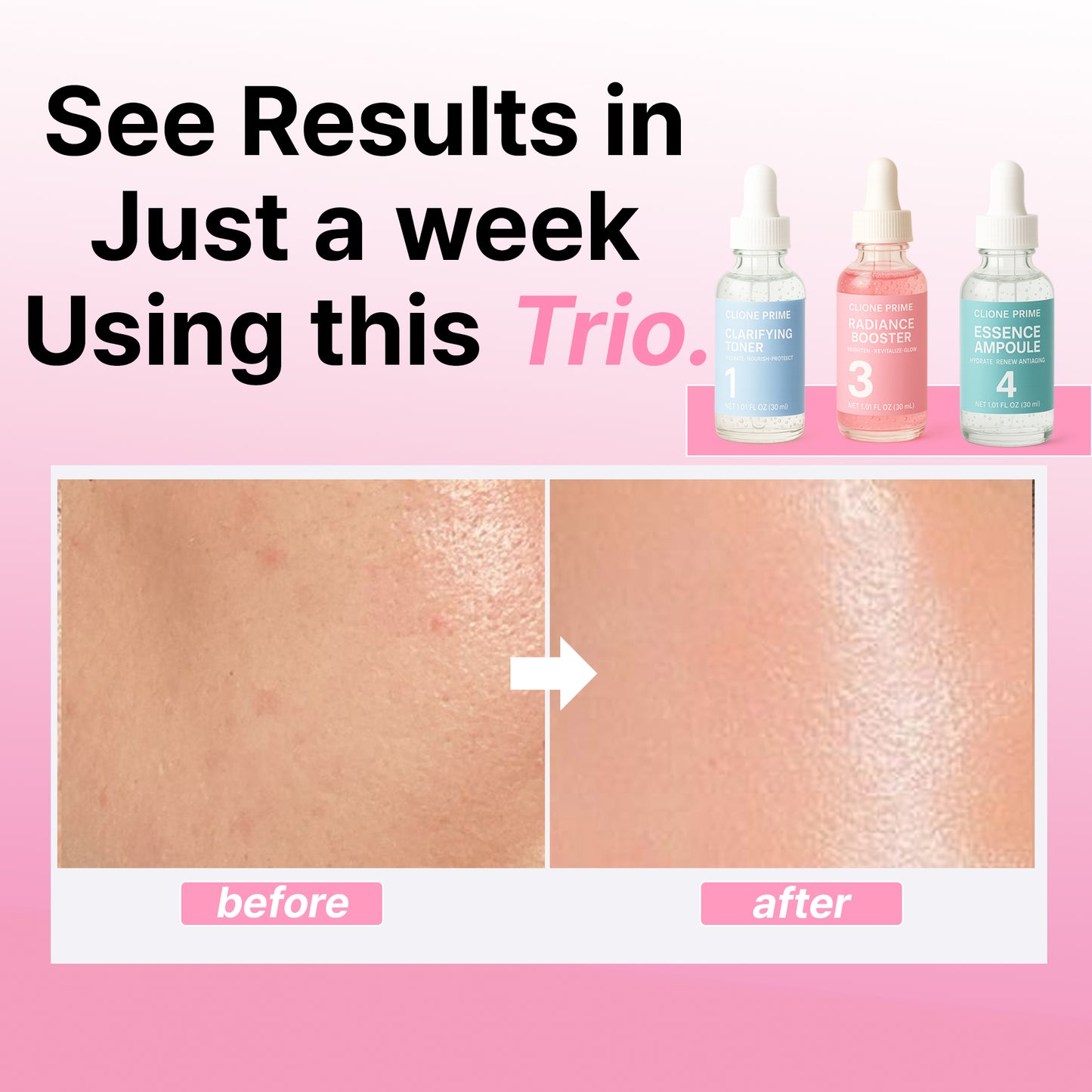 Glow-Up Skincare Set