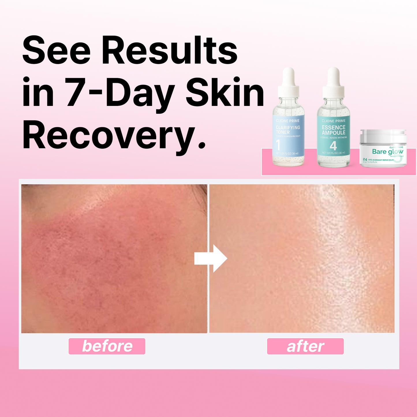 Night Repair & Hydration Skincare Set