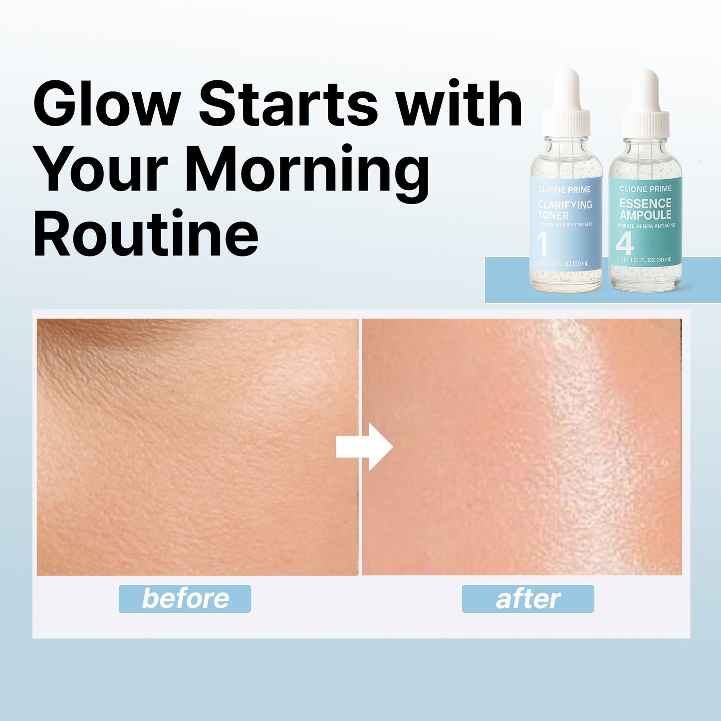 Morning Glow Skincare Set