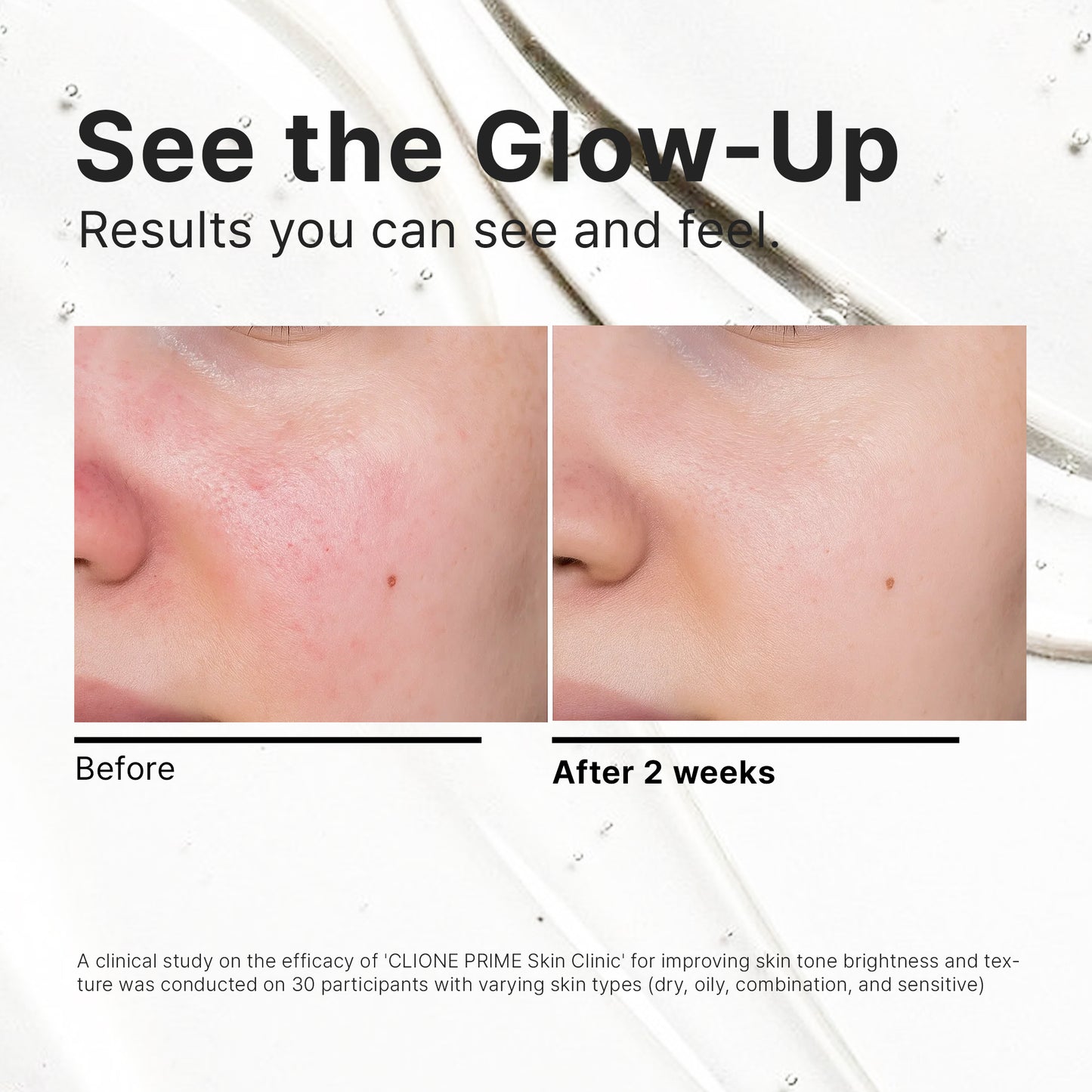 Korean Skincare Set