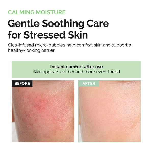 Dluxkin Calming Moisture Bubble Mask Pack