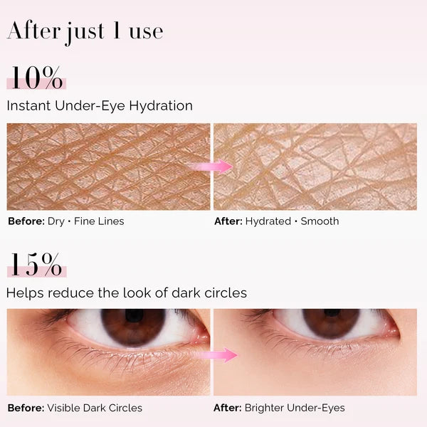 Dluxkin Under Eyepatch (Nourishing & Revitalizing Eye Patches for dark circles)