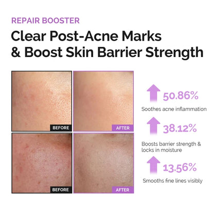 Dluxkin Repair Booster Bubble Mask Pack