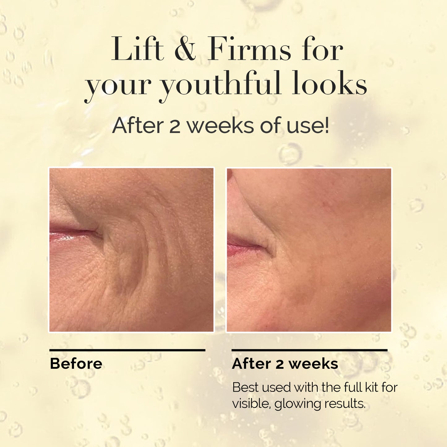 Magic V-Line Mask - Step 2