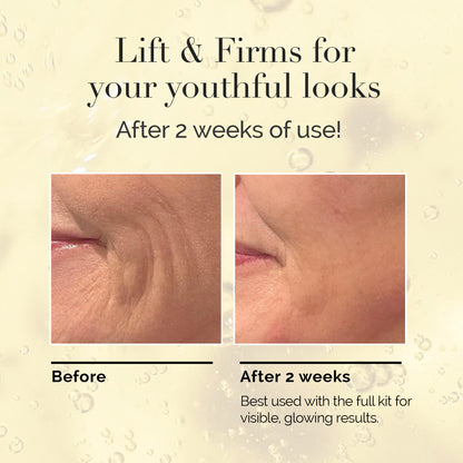 Magic V-Line Mask - Step 2